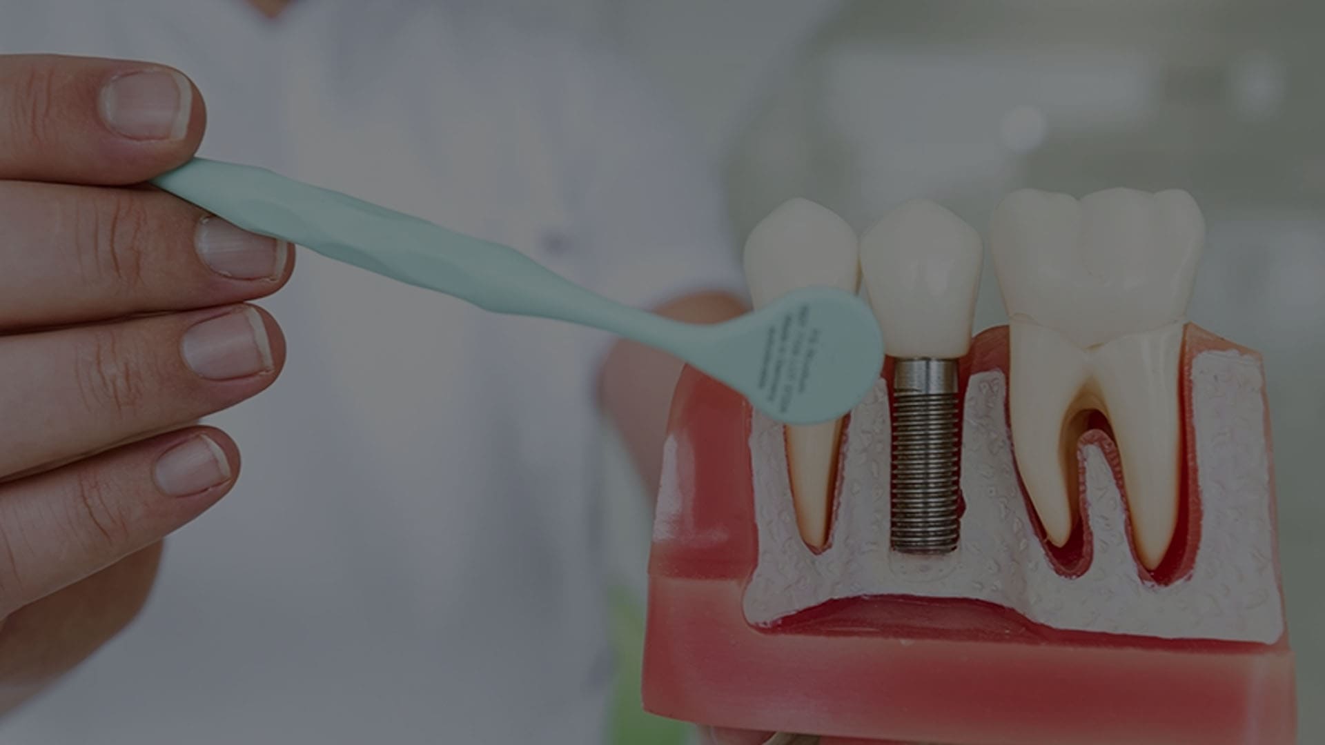 dental implant treatment