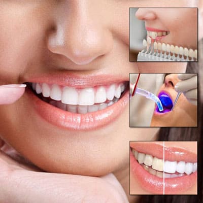 General dentistry in chennai