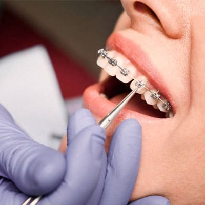 Ortho dentistry in dharmapuri